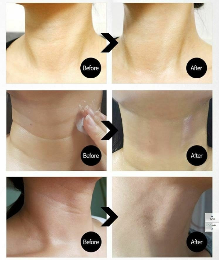 Premium Collagen Naite Thread Neck Cream 2.0