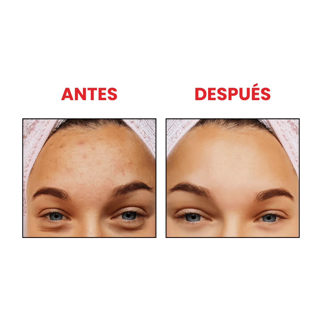 Glow Serum Beauty of Joseon con niacinamida para reducir manchas e iluminar.