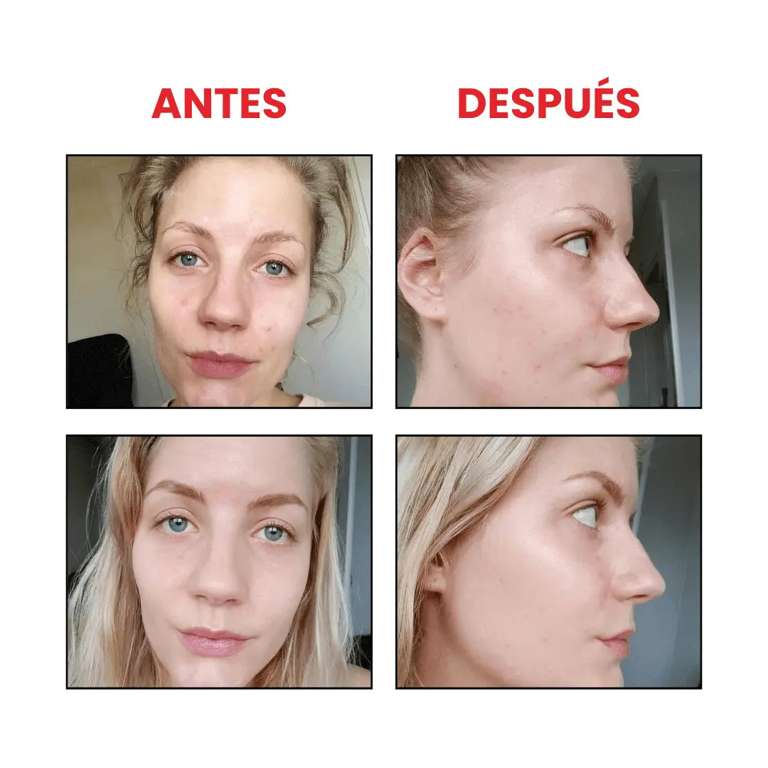 Niacinamide + Zinc The Ordinary que suaviza textura e imperfecciones.