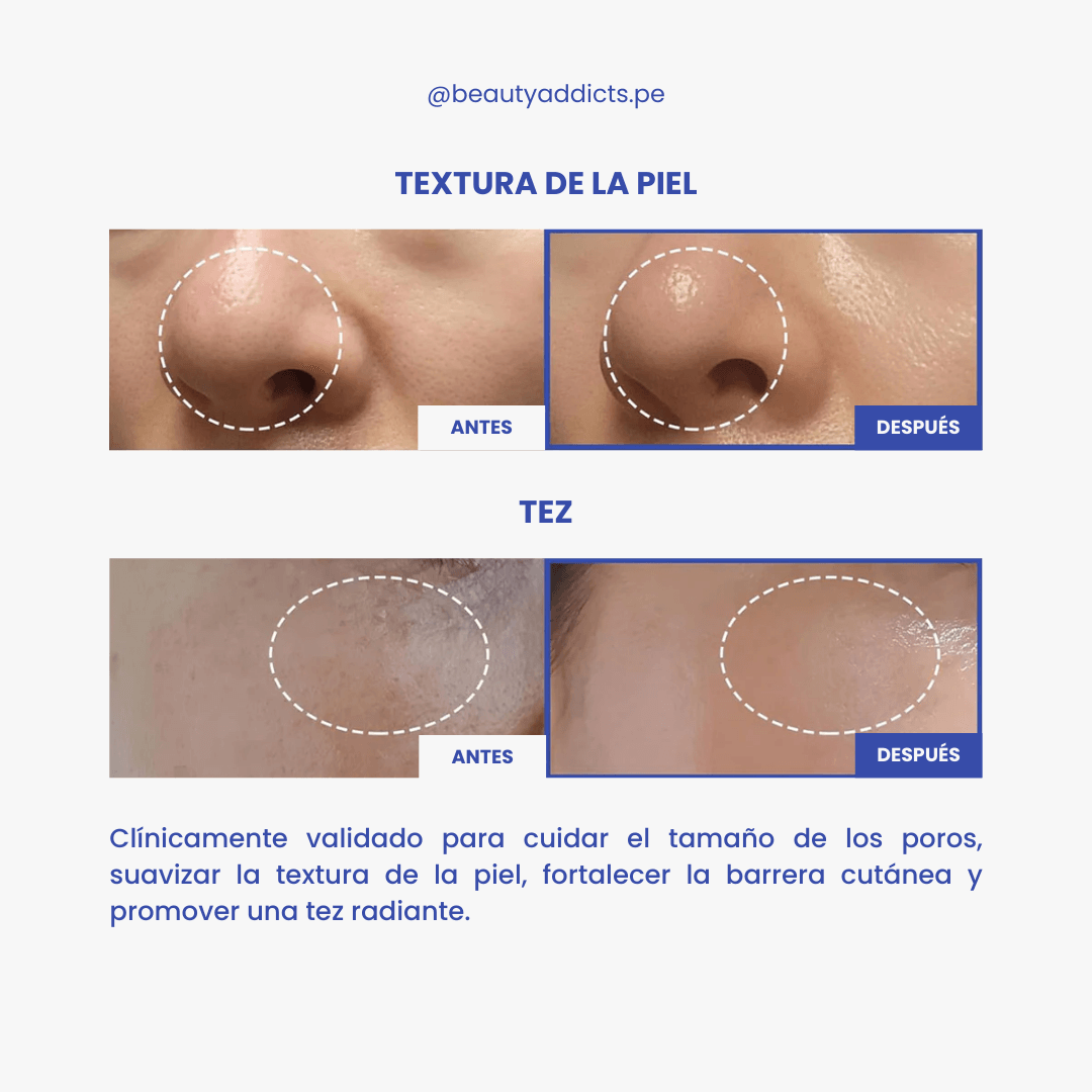 Tratamiento intensivo Medicube para poros, elasticidad y luminosidad.