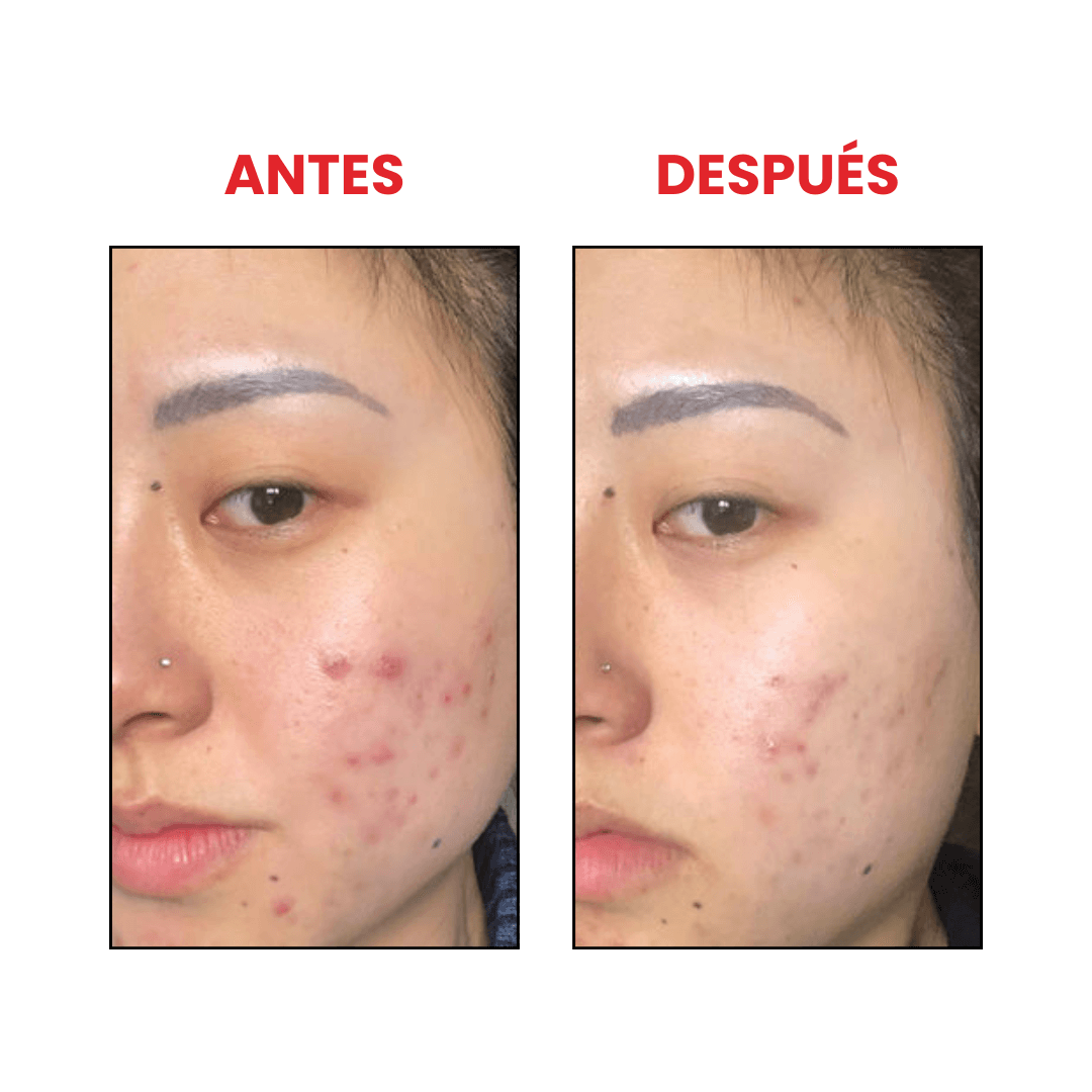 Salicylic Acid Daily Gentle Cleanser