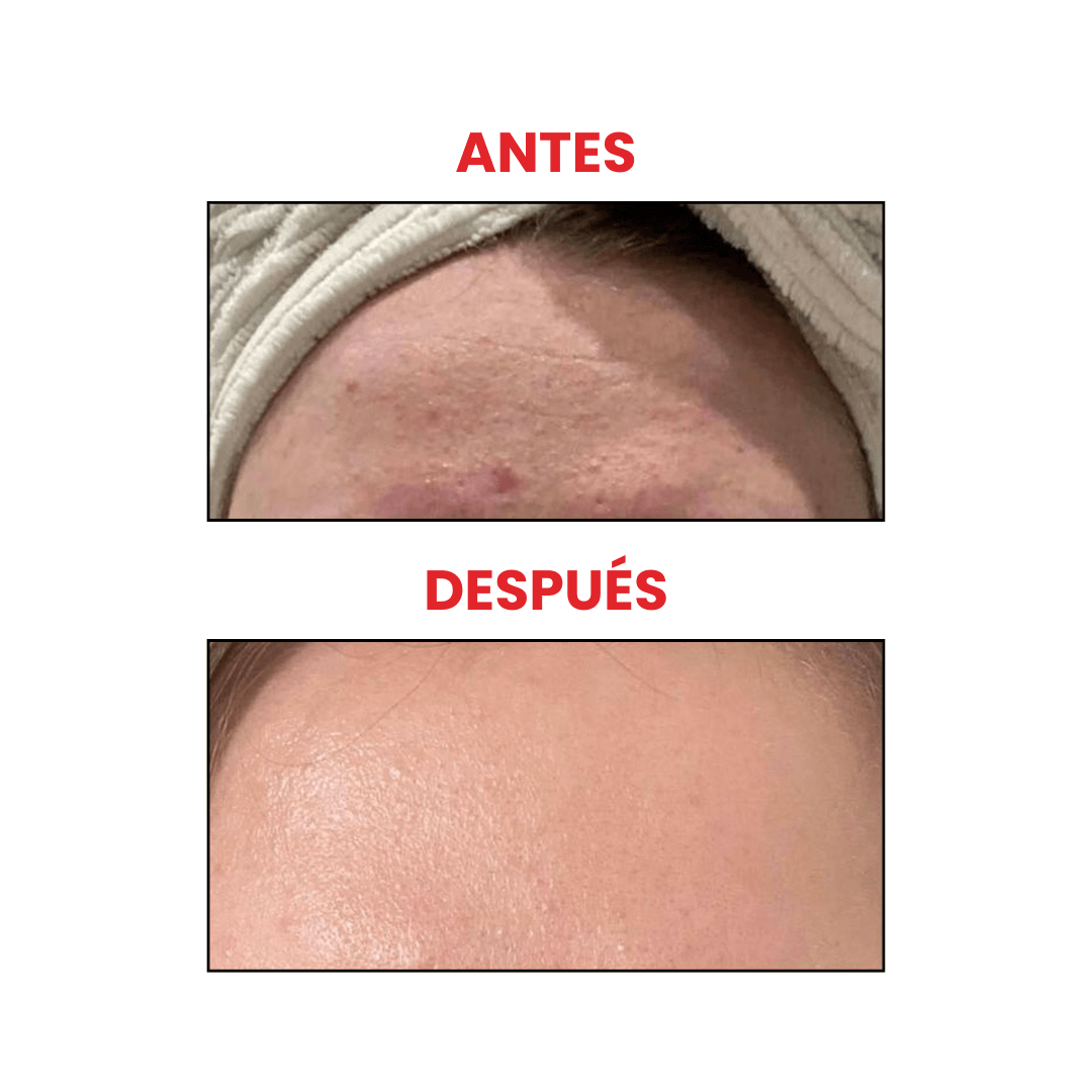 Snail 96 mucin power essence