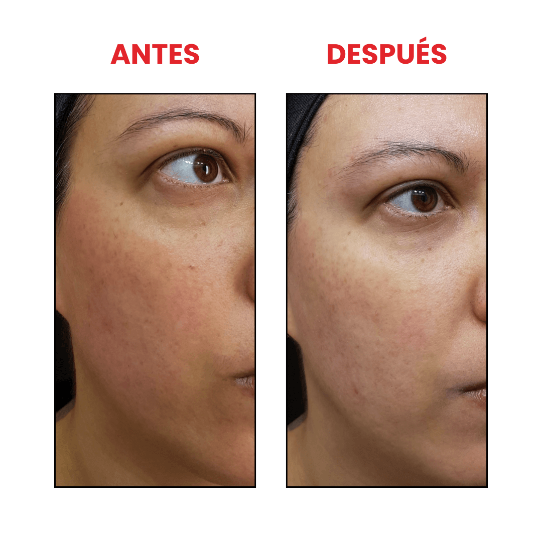The Vitamin C 23 Serum
