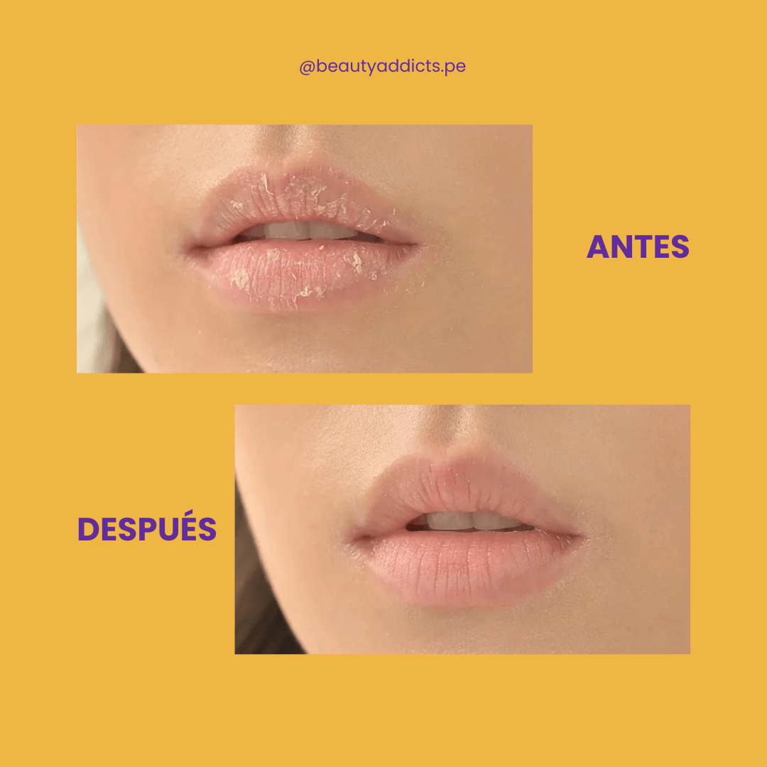 Frudia Blueberry Hydrating Honey Lip Balm repara labios agrietados con miel.