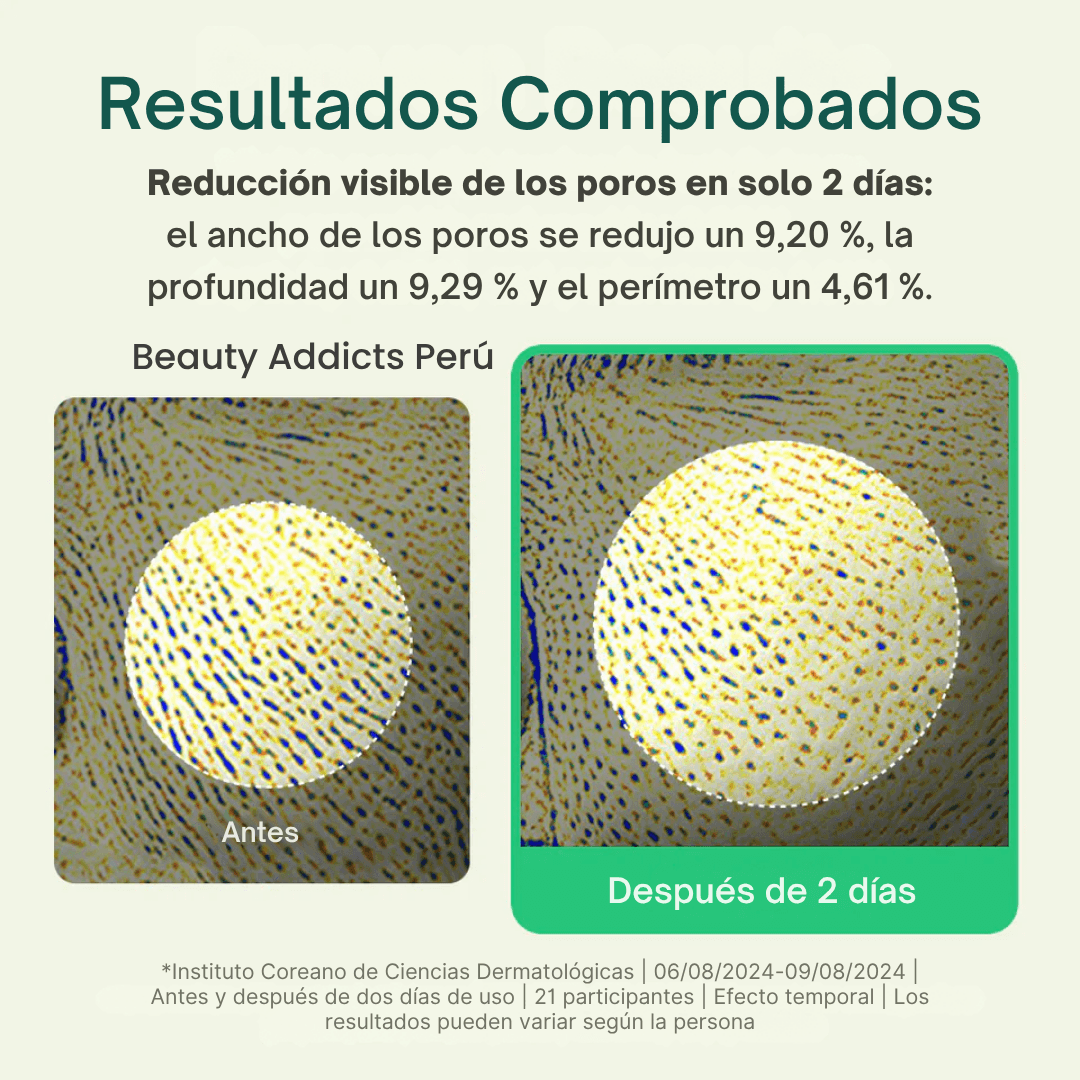 Polvo calmante que ayuda a secar granitos y mejorar textura irregular.