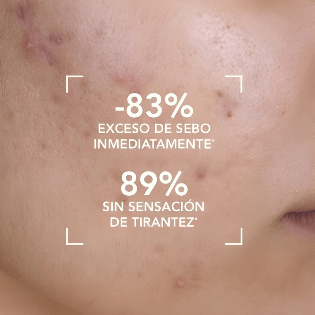 Sébium Gel Moussant Bioderma respeta el equilibrio natural de la piel grasa o mixta.