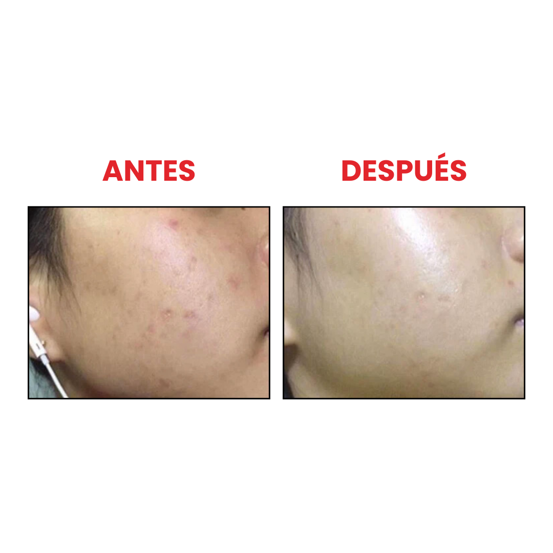 Axis-Y Dark Spot Correcting Glow Serum que combate opacidad y manchas.