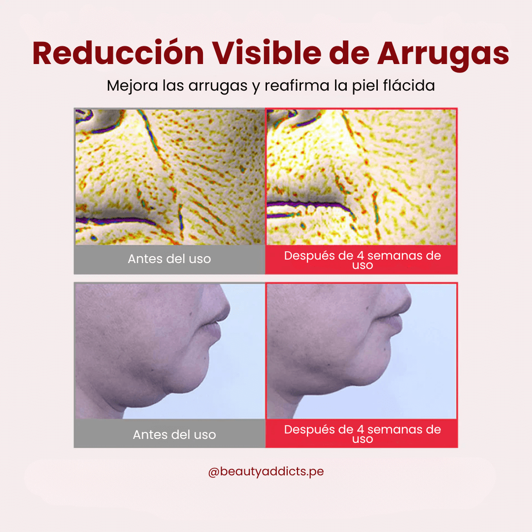 Madeca Cream Time Reverse Centellian24 hidrata profundamente y rellena líneas finas gracias al ácido hialurónico.