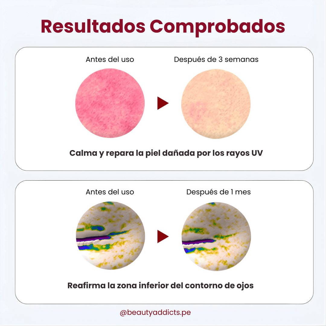 CENTELLIAN24 Madeca Derma Mask III reafirma la zona inferior del contorno e ojos.