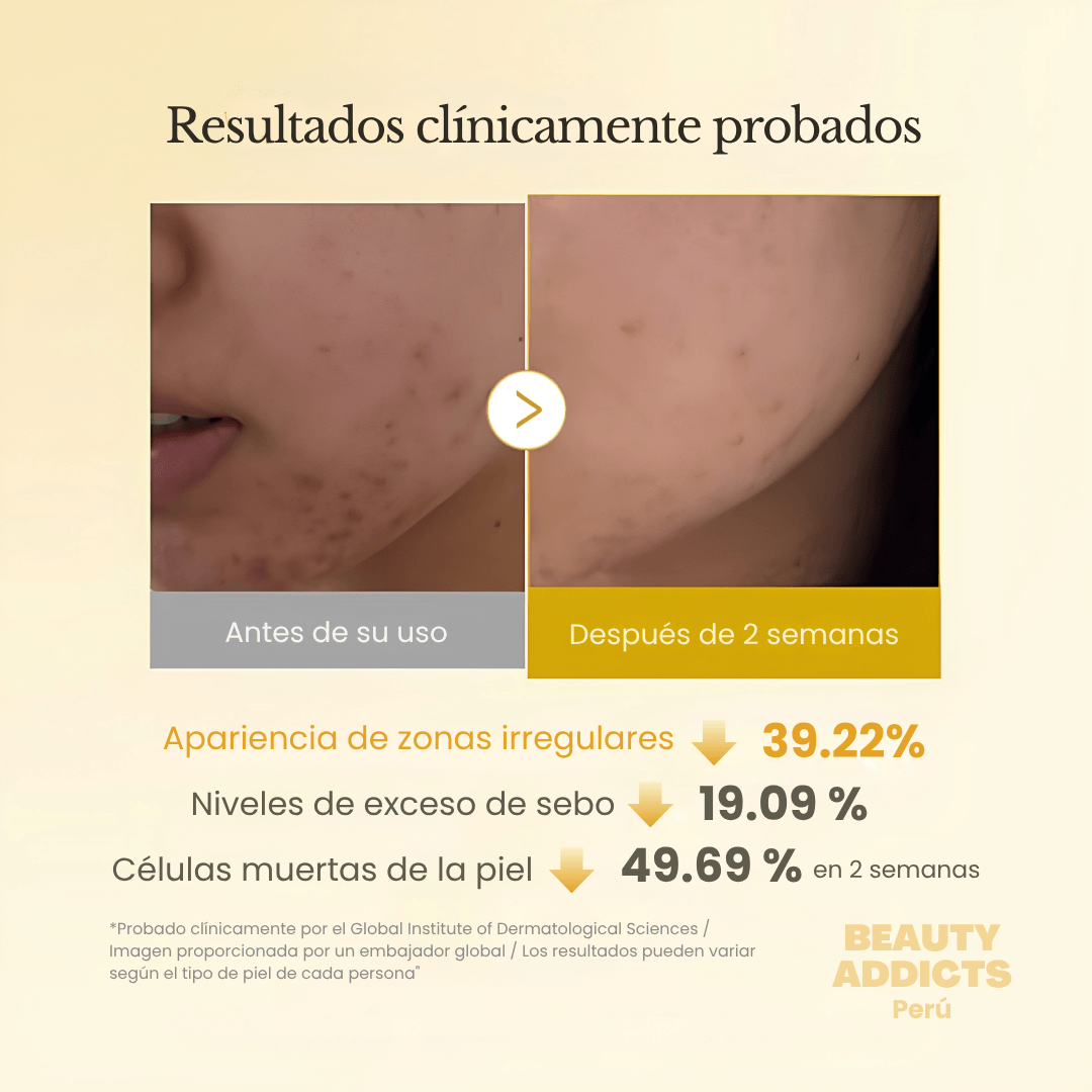 Kojic Acid Turmeric Pad formulados para mejorar la apariencia de hiperpigmentación, marcas post acné y textura irregular de la piel.