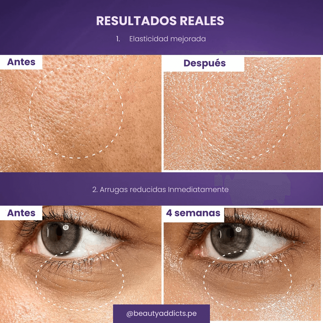 No.9 NAD Bio Lifting‑sil Essence con NAD+ y 50 péptidos que reafirma y atenúa arrugas en 4 semanas.
