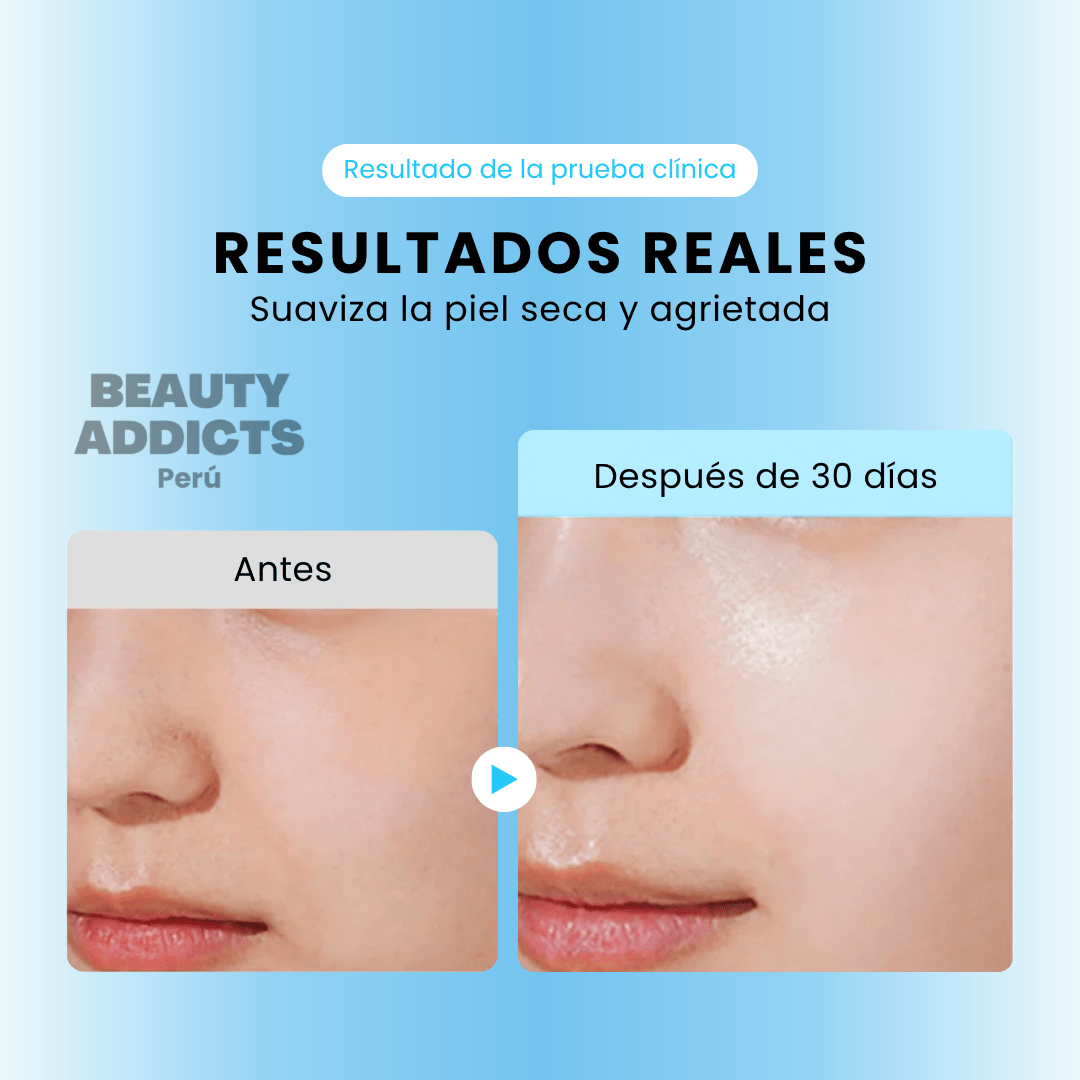 Tratamiento hidratante ideal para piel seca, apagada o con sensación de tirantez que necesita recuperar confort.