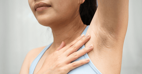 Cómo aclarar las manchas oscuras en el cuerpo