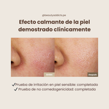 Dr. Althea 345 Relief Mist clínicamente demostrado que es bueno para la piel sensible y no es comedogénico.