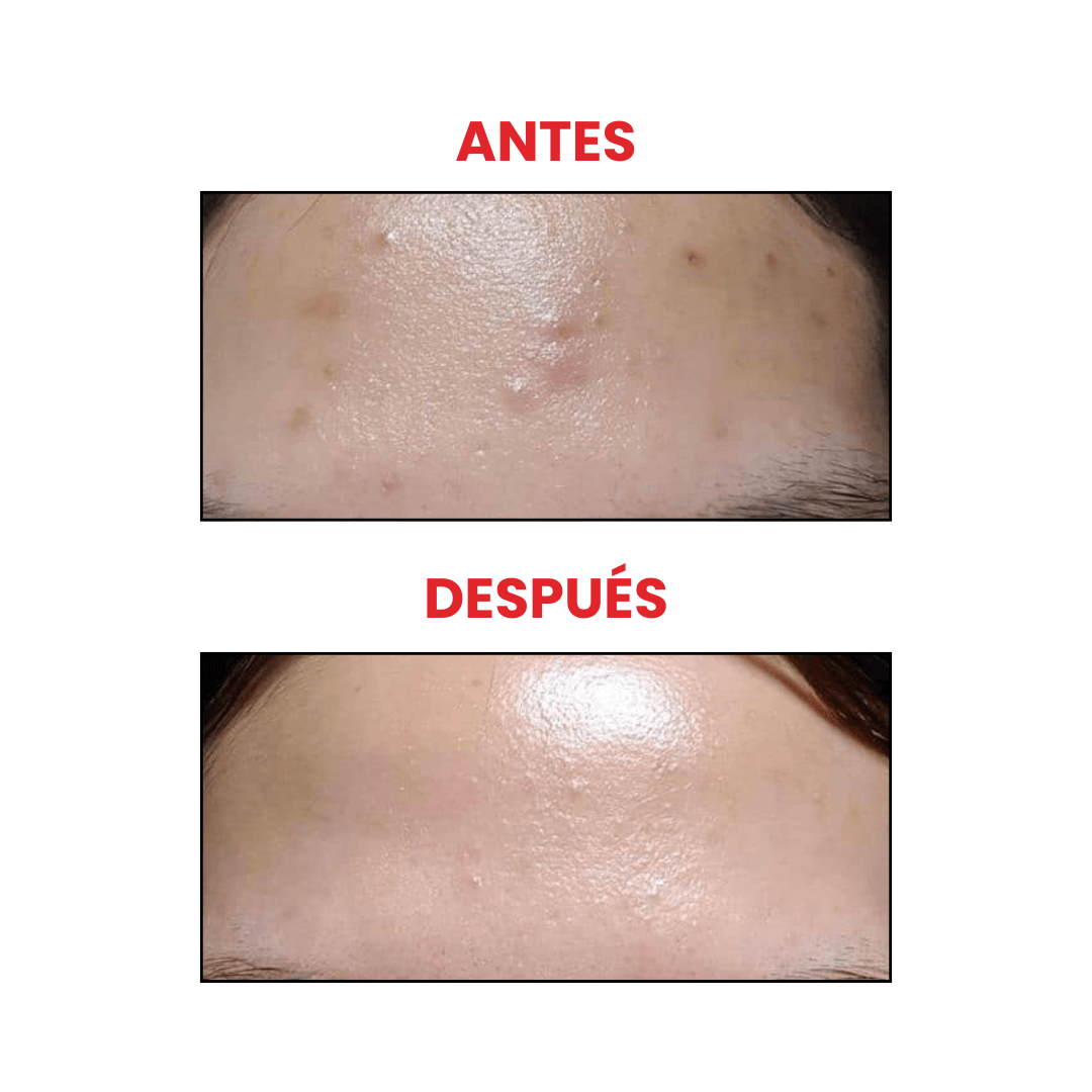 Tónico COSRX AHA/BHA que desobstruye poros y mejora uniformidad del tono.