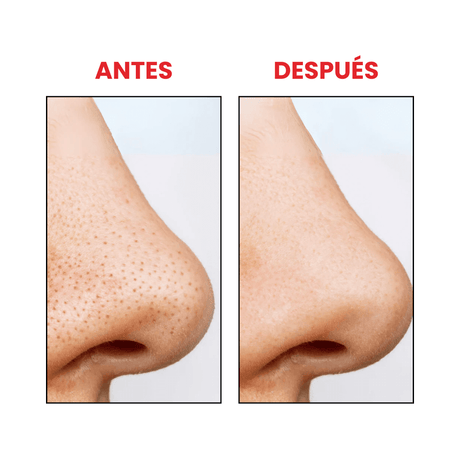 Antes y después del aceite limpiador facial Heartleaf Pore Control de Anua, formulado para limpiar a fondo los poros y mantener la piel suave y equilibrada.