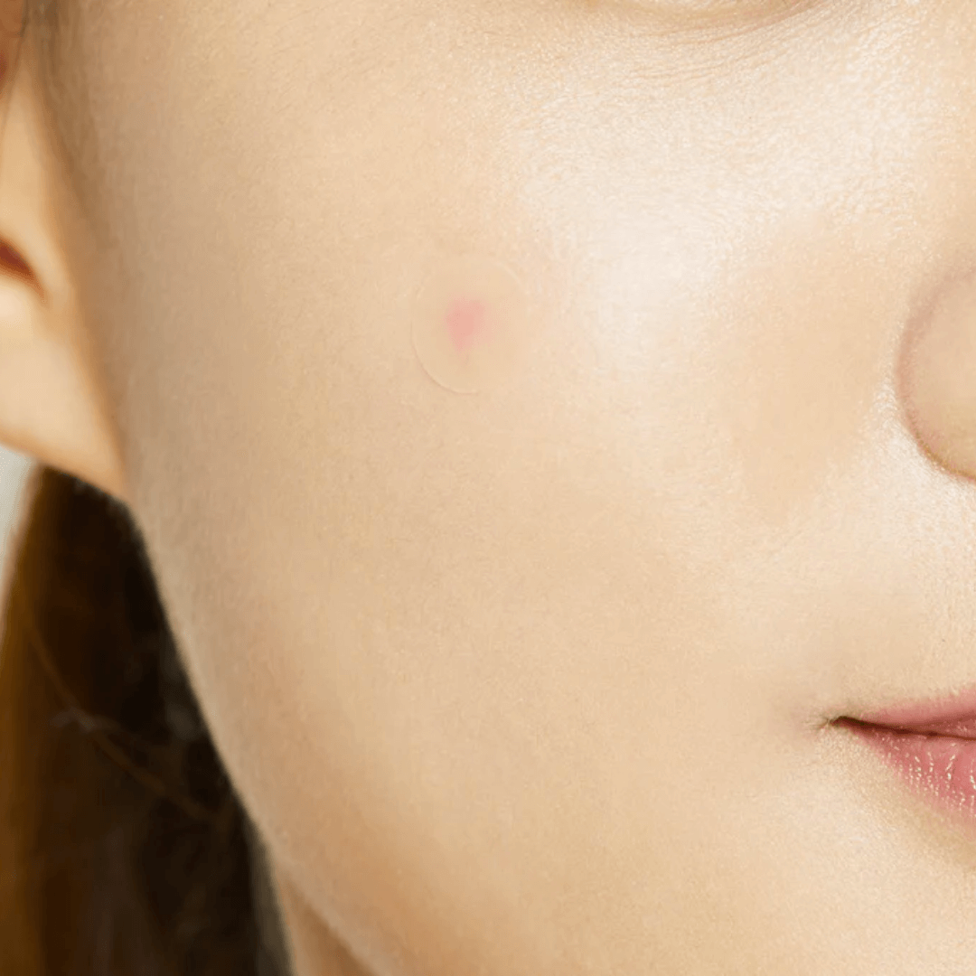 Acne pimple master patch | Parches para acné