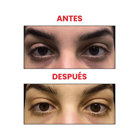 Suero contorno de ojos The Ordinary con 5 % de cafeína y antioxidantes de té verde.