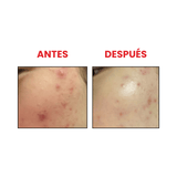 Calming Serum Green Tea Panthenol Beauty of Joseon, suero que calma e hidrata.