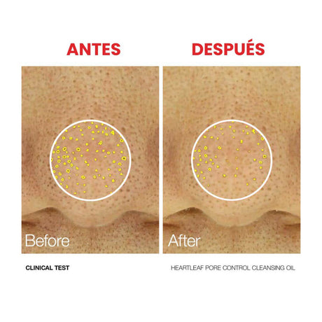 Antes y después de la doble limpieza de Anua. Combinación de aceite y espuma limpiadora.