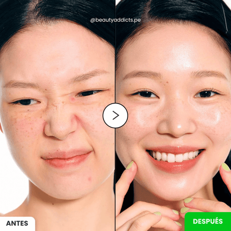 Suero coreano Eqqualberry con aloe vera y PDRN regenerador.
