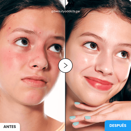 Eqqualberry Hyaltoin Serum para piel luminosa y flexible.