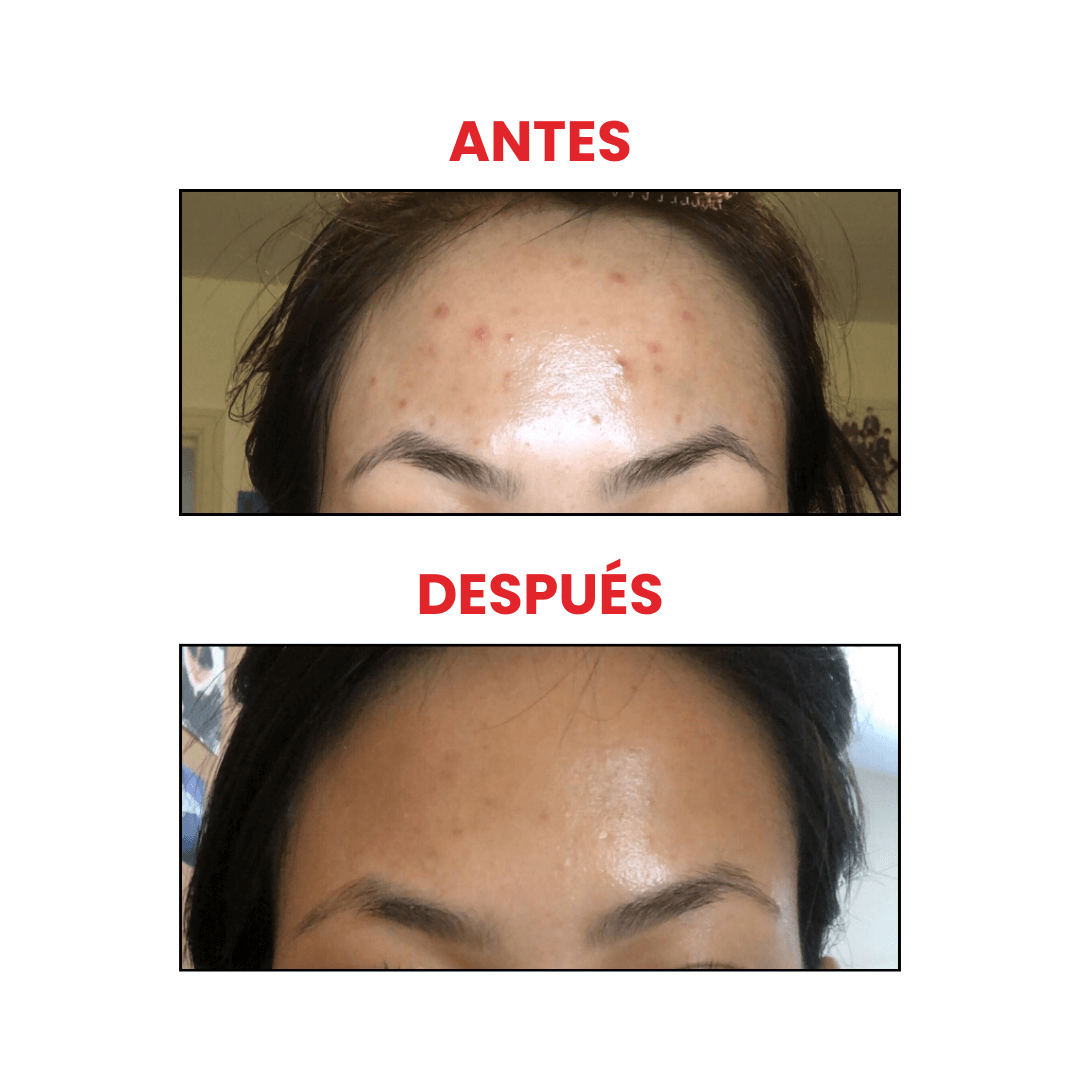 Ácido glicólico 7% Glycolic acid 7% toning solution