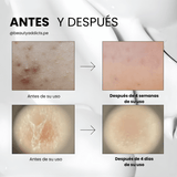 Mild Reedle Shot 50 VT Cosmetics reduce la apariencia de micro‑relieves y marcas recientes de acné. 