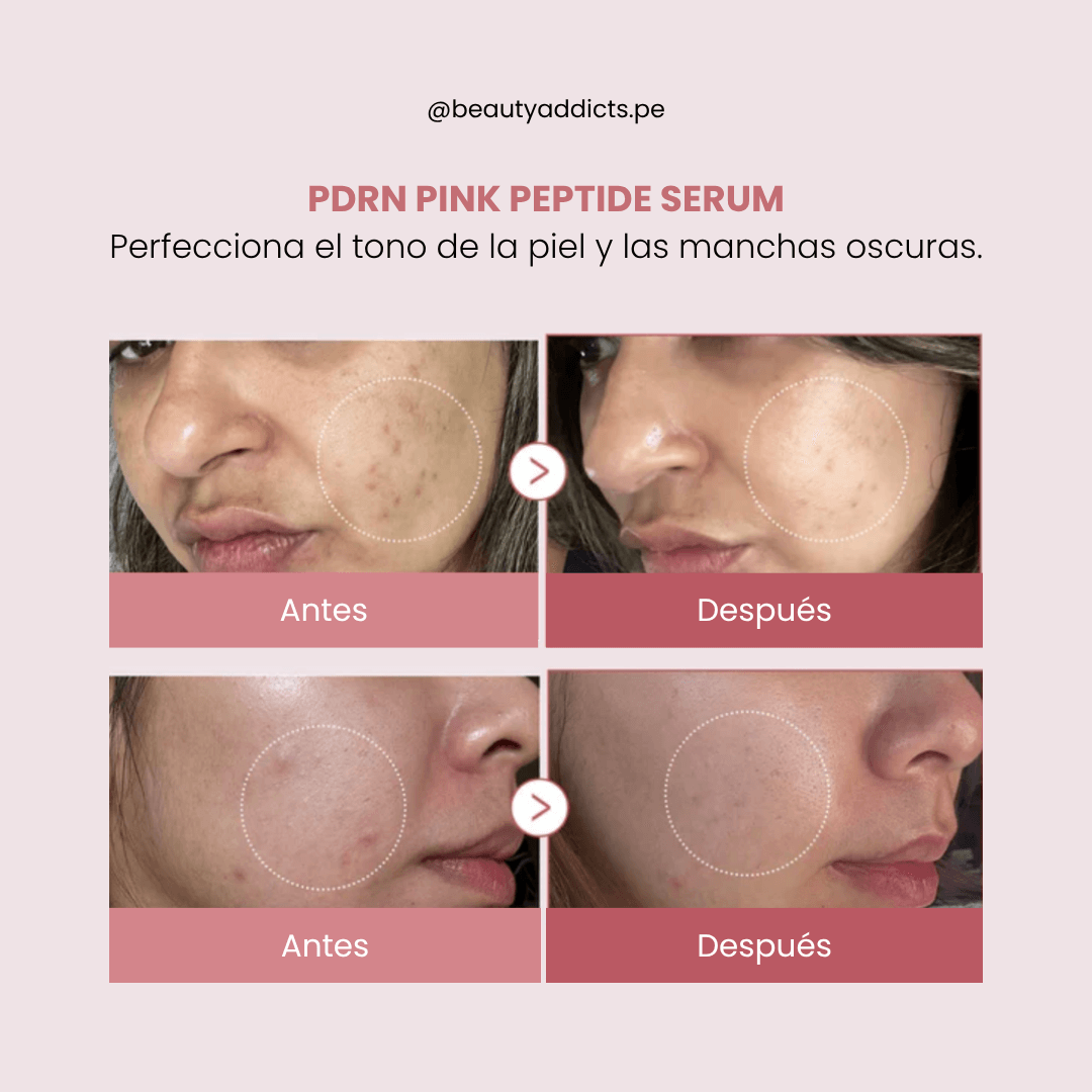 Medicube serum con PDRN, antes y despues.