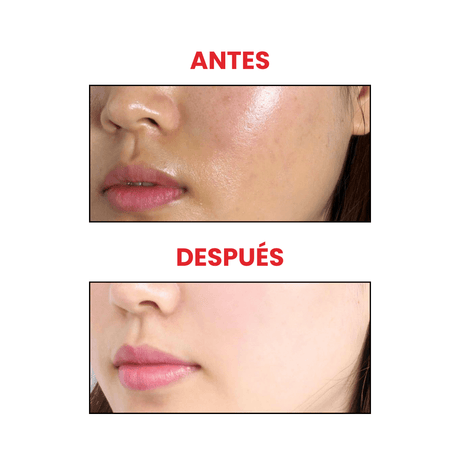 Antes y después del sérum facial Peach 70 Niacinamide de Anua, fórmula refrescante para hidratar, equilibrar y aclarar el rostro.