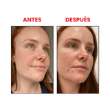 Ácido salicílico 2% Salicylic acid 2% solution