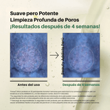 Antes y después del aceite limpiador facial Heartleaf Pore Control de Anua, formulado para limpiar a fondo los poros y mantener la piel suave y equilibrada.