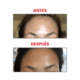 Glycolic Acid 7% The Ordinary que suaviza líneas finas y textura áspera.