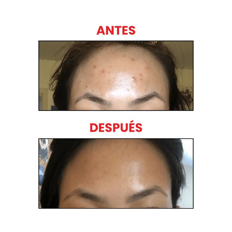 Glycolic Acid 7% The Ordinary que suaviza líneas finas y textura áspera.