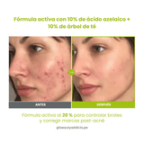 Azelaic Acid 10 Kojic Azulene Serum Purito SEOUL controla el acné y suaviza marcas postinflamatorias.