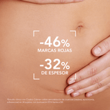 Cicabio Crema SPF 50 Bioderma acelera la reparación cutánea y previene manchas post lesión.