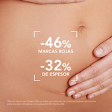 Cicabio Crème Bioderma favorece cicatrización y mantiene la piel flexible y confortable.