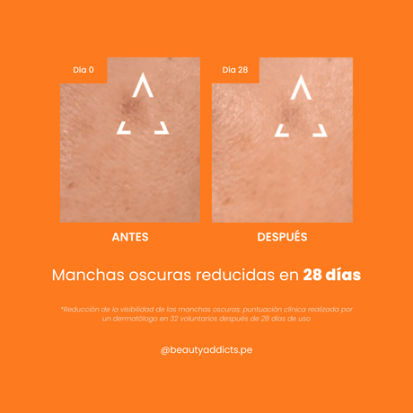 Uriage Depiderm Serum Booster que ilumina y despigmenta manchas oscuras del rostro.