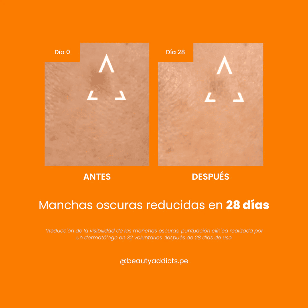 Serum facial Uriage despigmentante con 94 % de ingredientes naturales y textura ligera apta para piel sensible