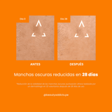 Serum facial Uriage despigmentante con 94 % de ingredientes naturales y textura ligera apta para piel sensible