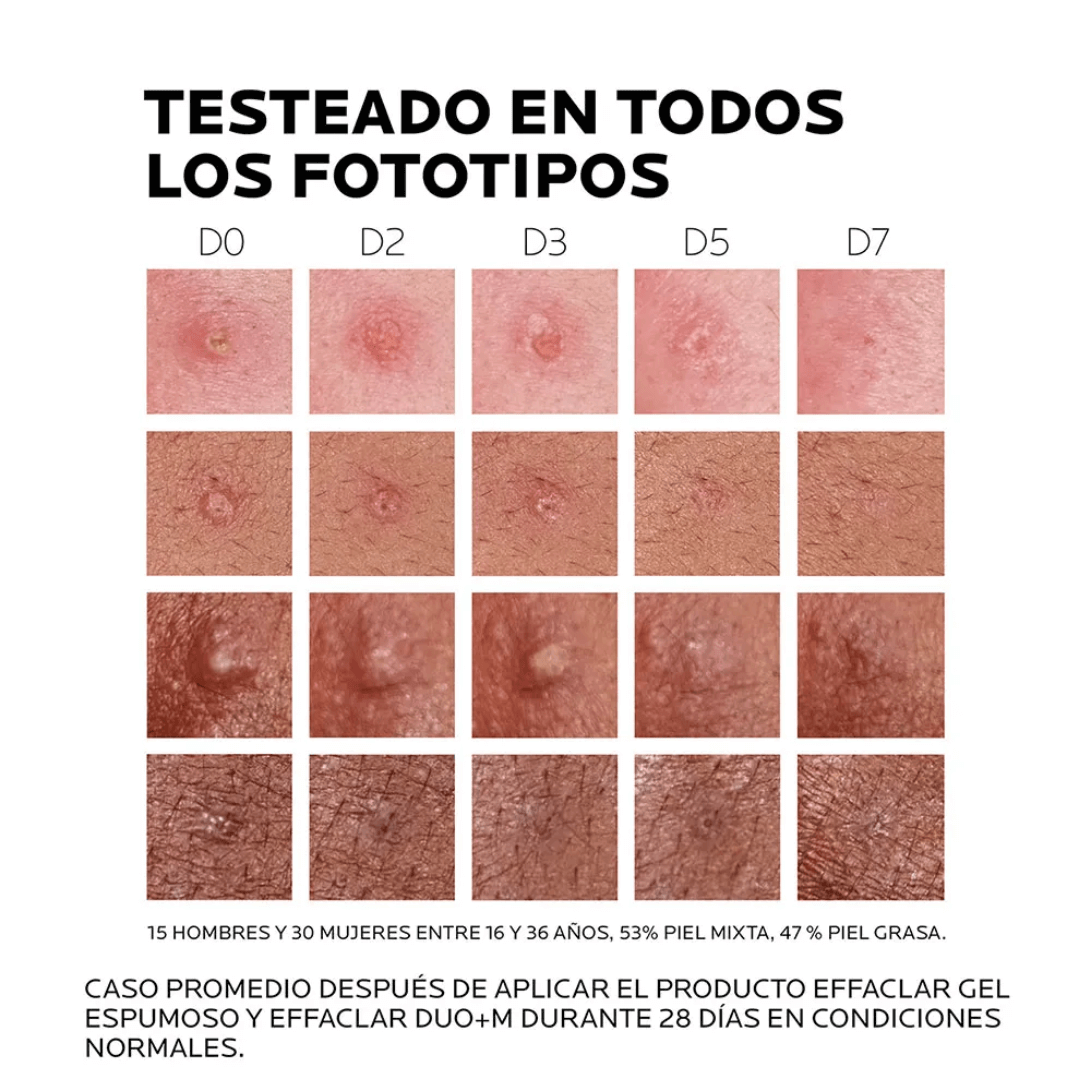 Effaclar Duo M de La Roche-Posay mejora textura y unifica el tono.