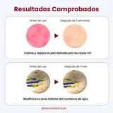 CENTELLIAN24 Madeca Derma Mask III reafirma la zona inferior del contorno e ojos.