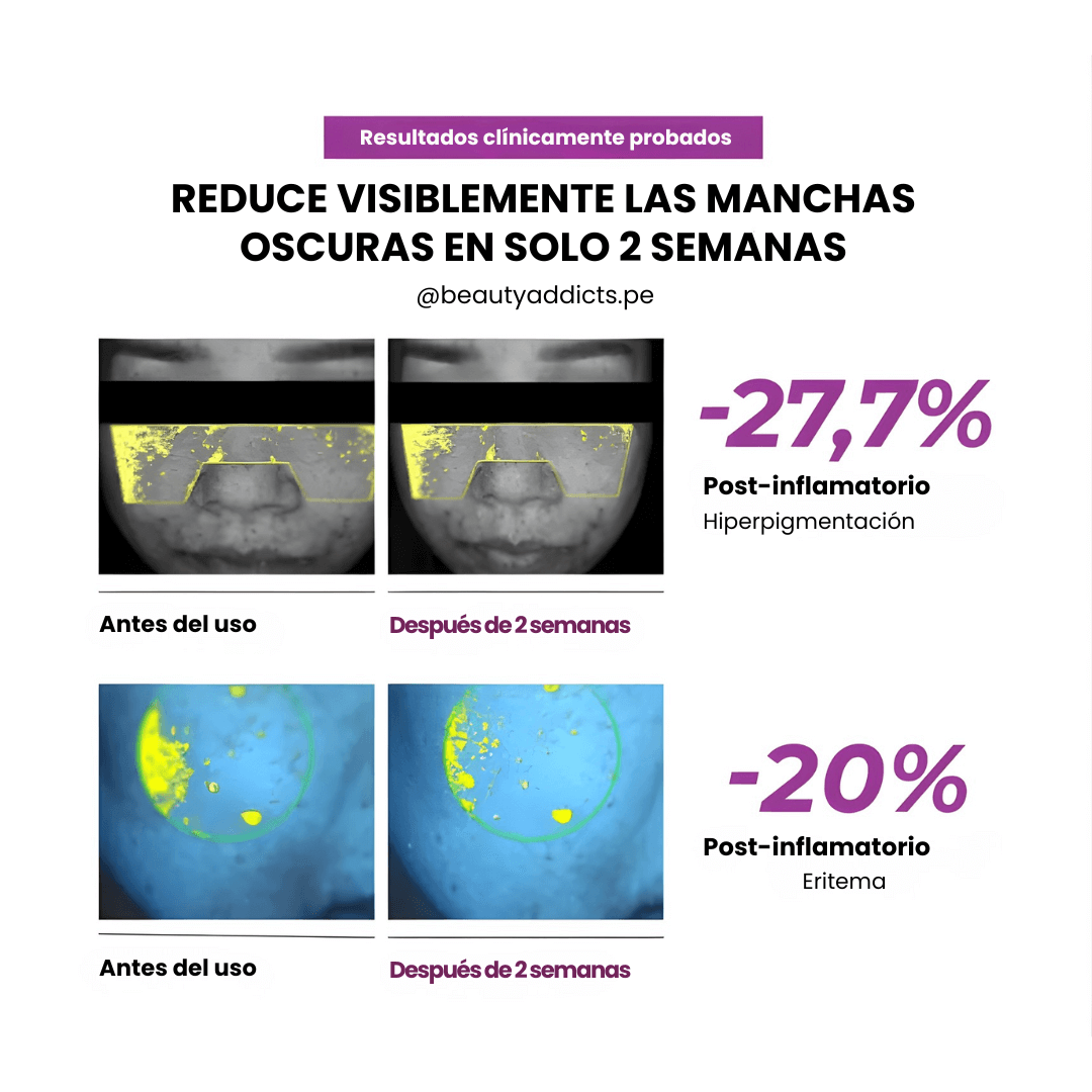 Niacinamide 20 Serum Jumiso reduce hiperpigmentación y mejora la claridad del rostro.