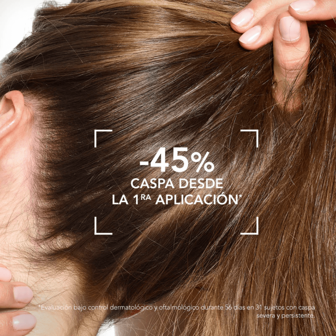 Nodé DS+ Shampooing Bioderma mejora la textura del cabello y reduce el exceso de grasa.