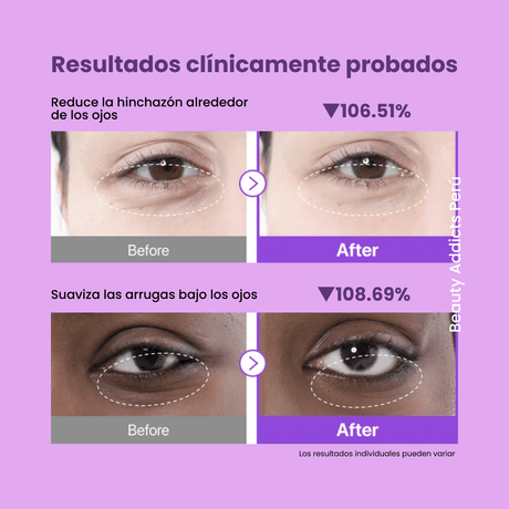 Parches hidrogel con colágeno para mejorar elasticidad del contorno.