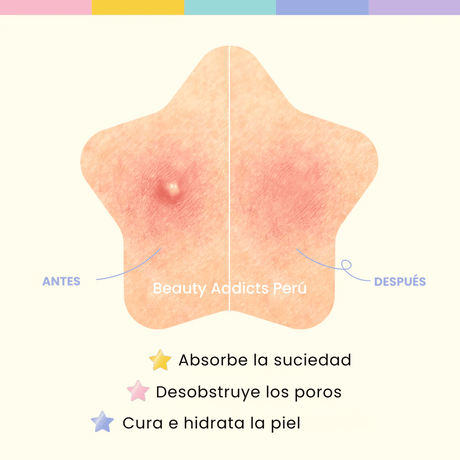 Star Spot Patch de OOTD ideales para cubrir imperfecciones y prevenir marcas post acné.