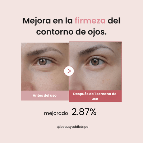 Medicube PDRN Pink Peptide Eye Serum mejora visiblemente la elasticidad en el contorno de ojos hasta un 2.87%.