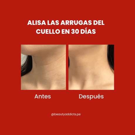 Medipeel Peptide Naite 1000 Neck Stick formulado con ingredientes que proporcionan un efecto tensor y lifting a la piel.