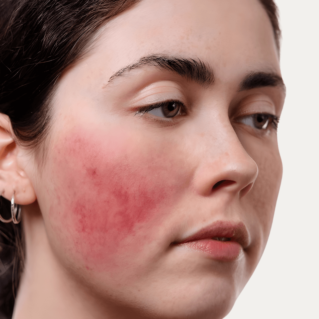 Sensibio Forte Bioderma alivia molestias y refuerza la barrera cutánea tras agresiones externas.