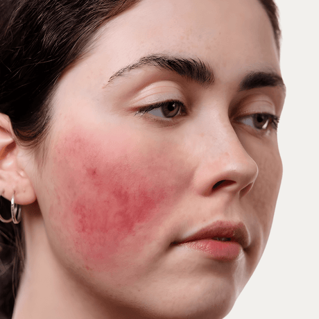 Sensibio Forte Bioderma alivia molestias y refuerza la barrera cutánea tras agresiones externas.